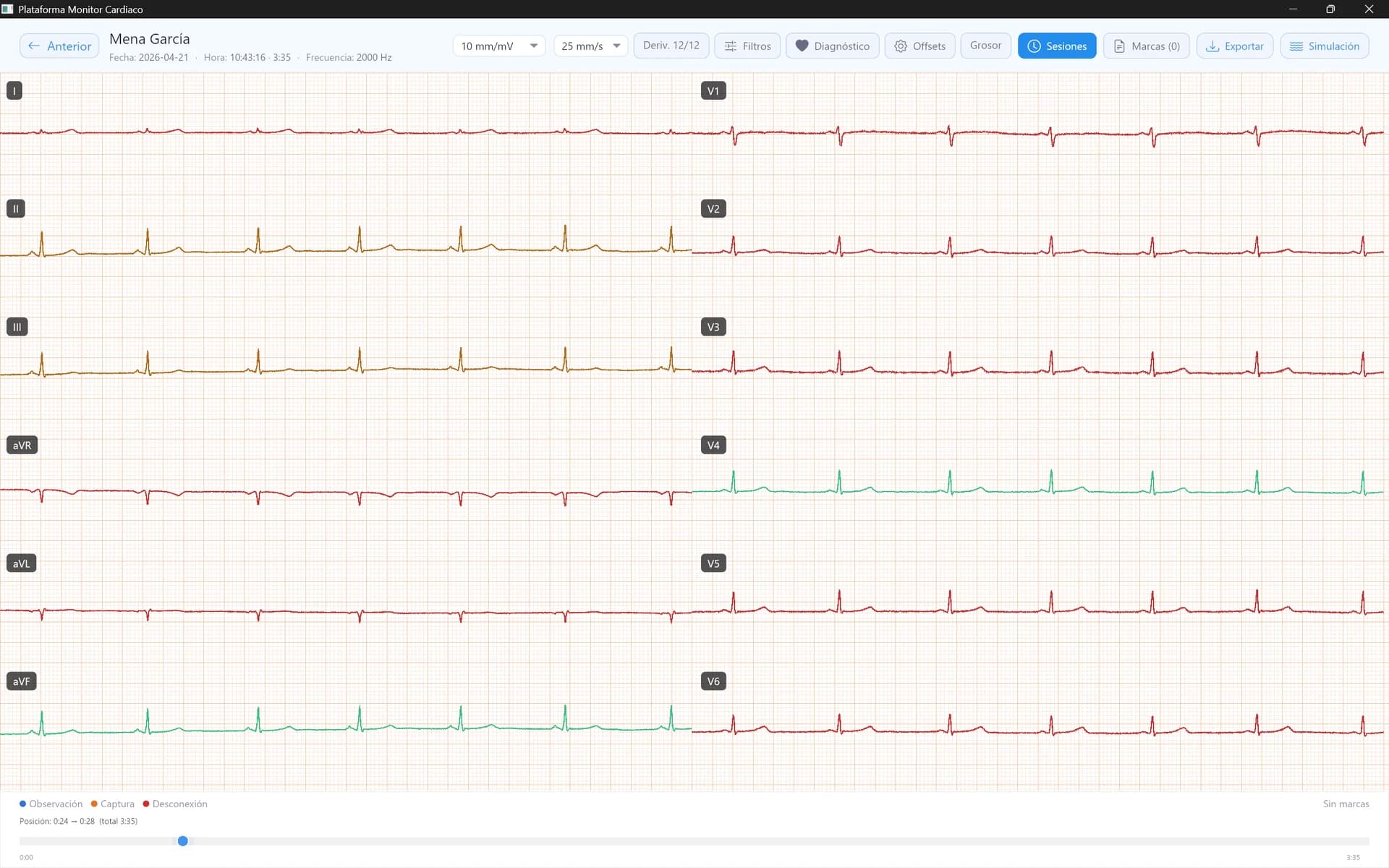 Monitor de ECG de 12 derivaciones en Rust — A1